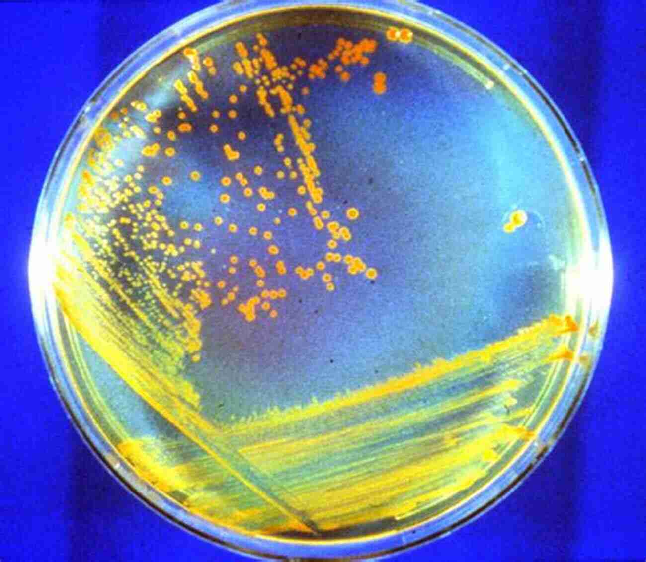 Psychrophile Microorganisms Thriving In Icy Environments Psychrophiles: From Biodiversity To Biotechnology